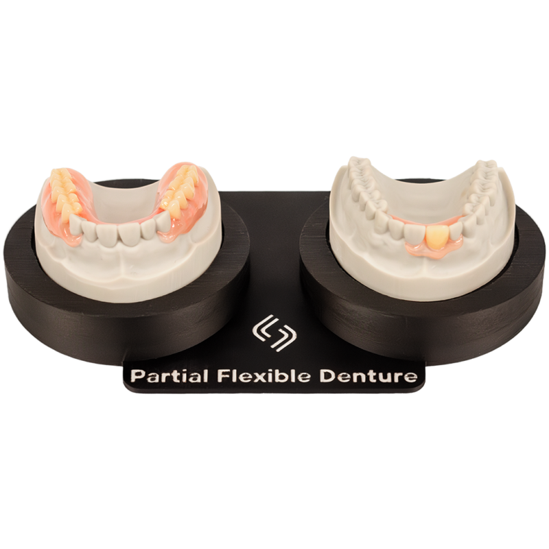 Partial Denture