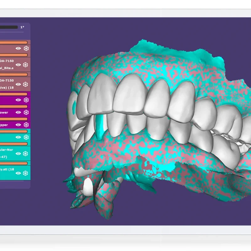 DesignA dental technician's design shown in SwiftConnect for the practice to review and approve.